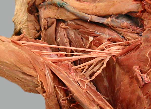 brachial plexus cadaver labeled