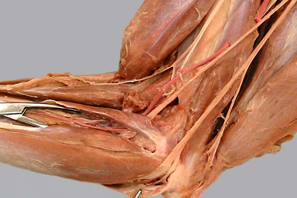 biceps brachii cadaver