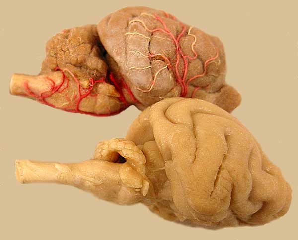 Cerebellum Image D1