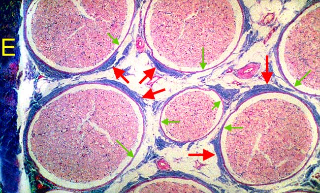 Nervous Tissue Microscope Slide Labeled - Micropedia