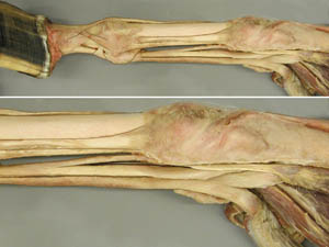 Ungulate Anatomy Lab 2 Thoracic Limb